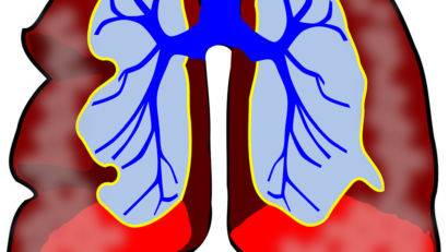 Spirometrii gratuite